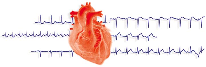 Die Variabilität des Herzrhythmus als Gradmesser der Gesundheit
